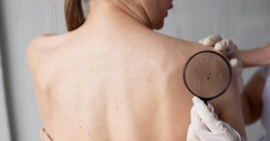 SAV realizó jornada de pesquisa de cáncer de piel