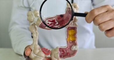 Pesquisa de cáncer colorrectal y anal: todo lo que debes saber