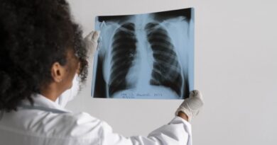 Cáncer de pulmón en Venezuela: la detección temprana es la gran aliada para salvar vidas