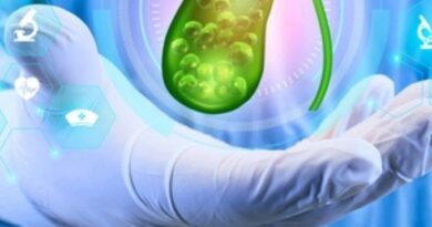 Atender a tiempo la litiasis vesicular evita complicaciones mortales